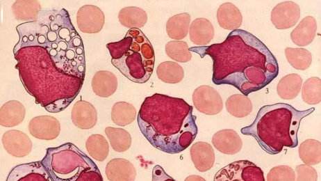 苏州外阴炎医院