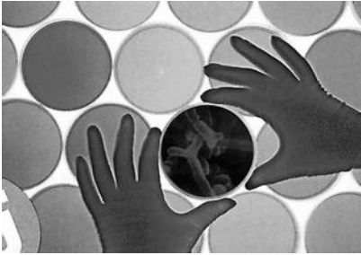 苏州外阴炎医院