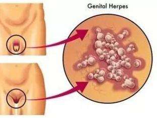 苏州治疗外阴炎医院