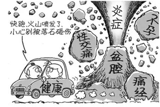 苏州盆腔炎医院