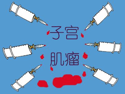 苏州子宫肌瘤医院