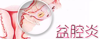 苏州盆腔炎权威医院