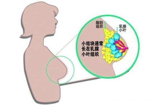苏州治疗乳腺医院