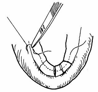 苏州处女摸修复医院