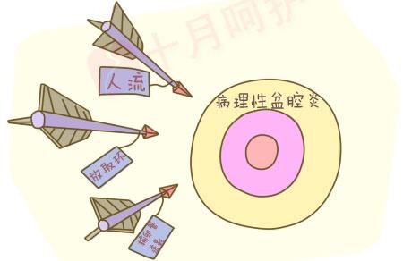 苏州盆腔炎治疗医院