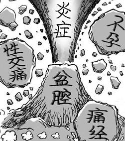 苏州盆腔炎医院