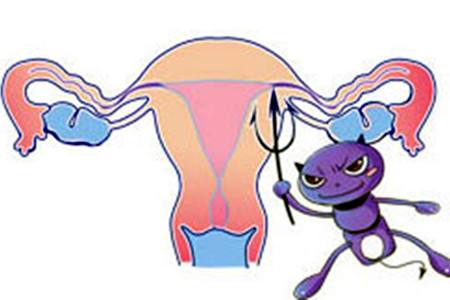 滴虫性阴道炎怎么护理