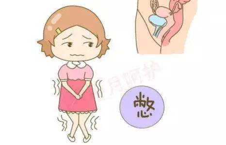 霉菌性阴道炎的治疗方法