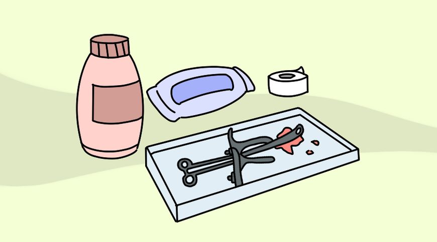 苏州怀孕多少天能做无痛人流