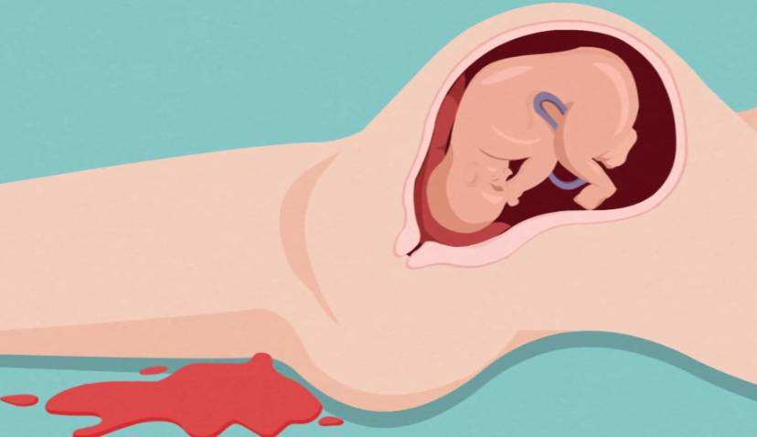 苏州人流哪家医院正规