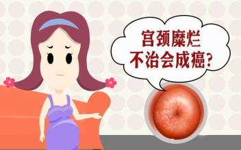 苏州治疗宫颈腐烂的医院