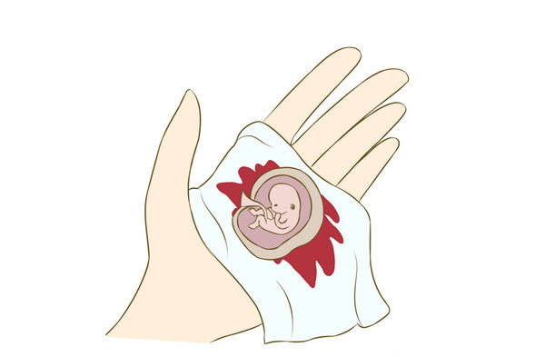 苏州好的药流医院