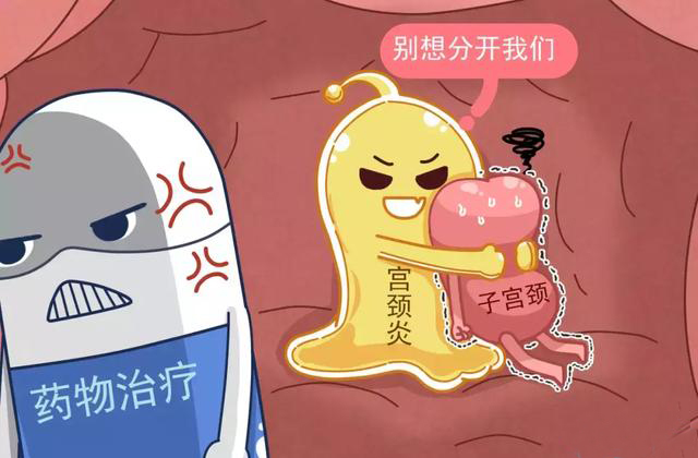 苏州宫颈炎后期的症状