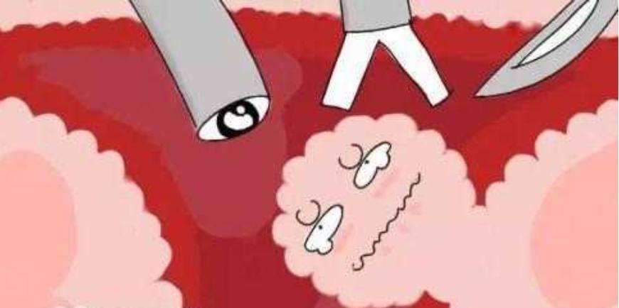 苏州治疗子宫肌瘤的医院