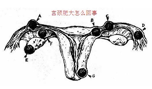 苏州治疗宫颈肥大的医院