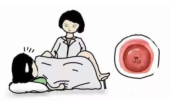 苏州治疗宫颈肥大哪里好