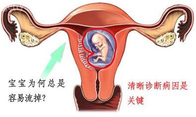 苏州到那里医院做流产好