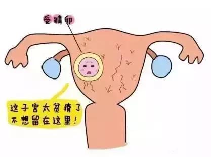苏州治疗子宫内膜炎哪里安全