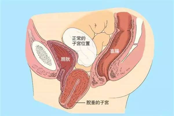 苏州治疗子宫内膜的医院
