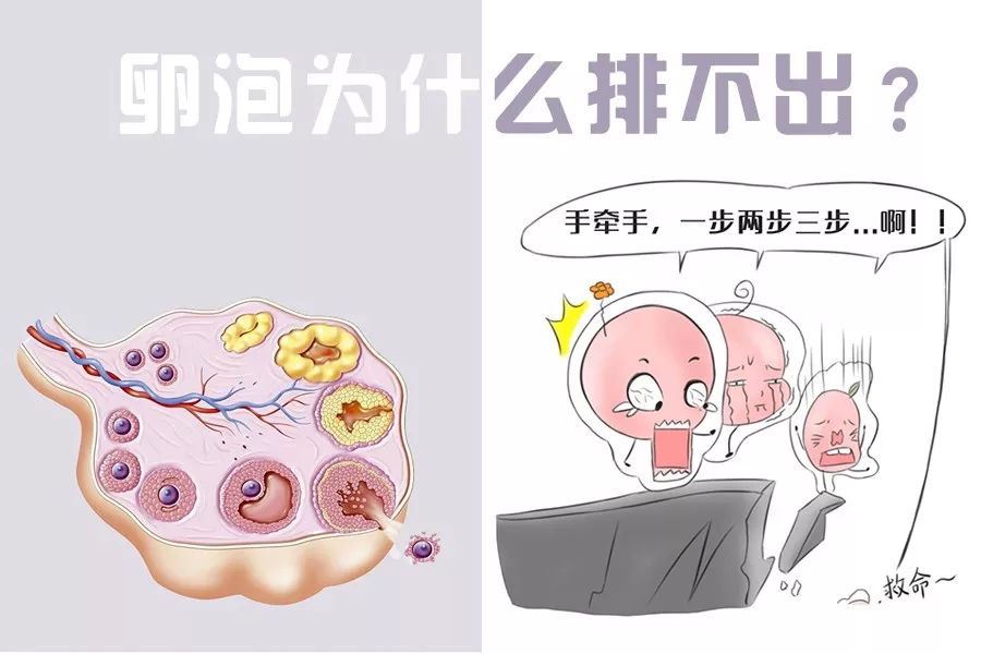 苏州治疗卵泡发育不良的医院