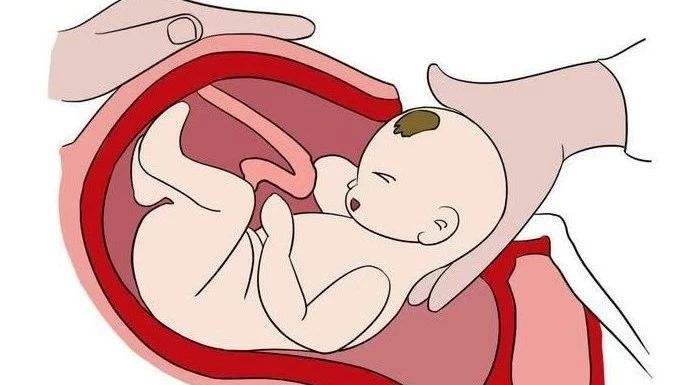 苏州剖腹产的医院