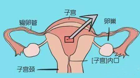 苏州治疗宫颈哪家医院好